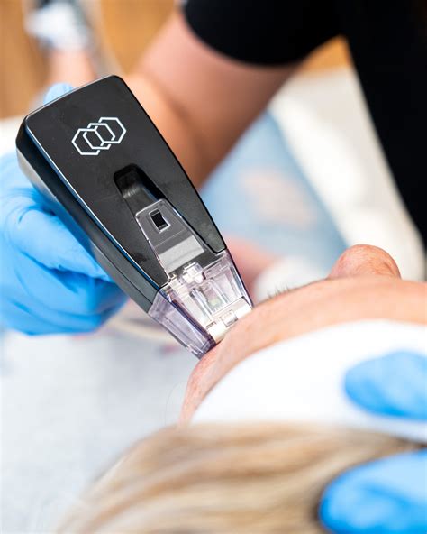 Revitalize Your Skin with Morpheus 8: Non-Surgical Rejuvenation