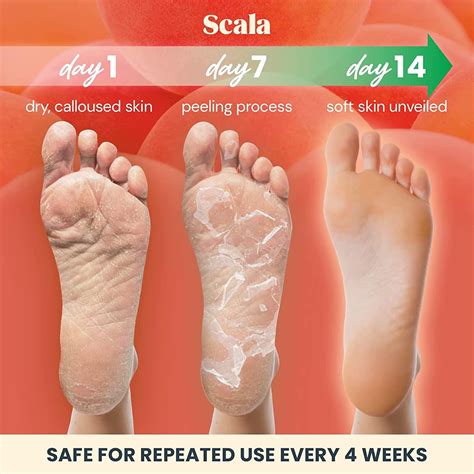 Scala Foot Peel Mask Treatment - 2 Pack Dead Skin Remover & Exfoliator