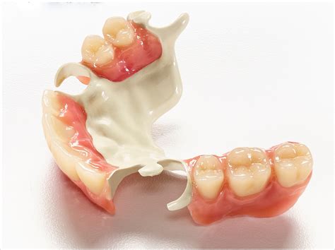 RPD Polymer Validated for CAD/CAM Workflows - Dentistry Today