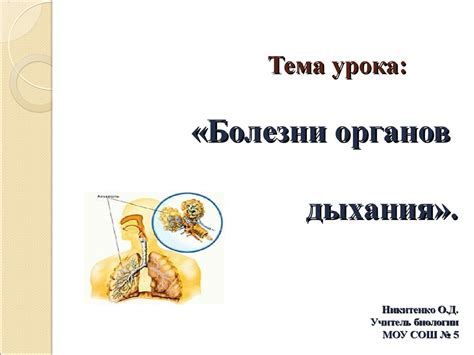Болезни органов дыхания - презентация онлайн