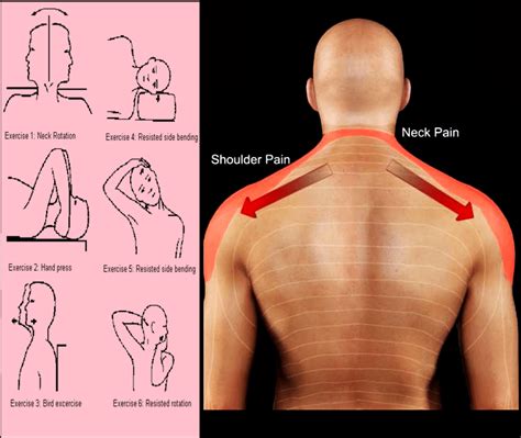 Resistance Band Exercises For Cervical Spondylosis at Ma Robert blog