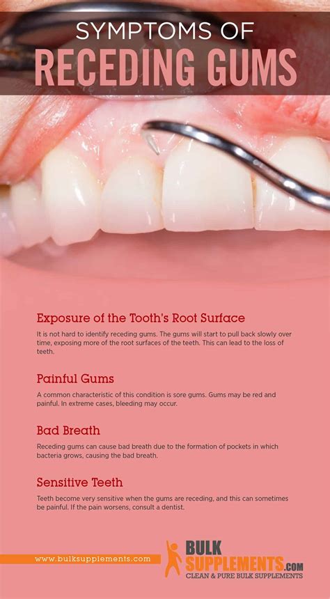 Receding Gums