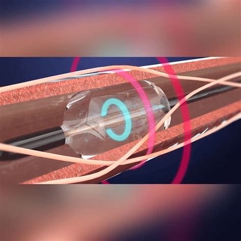 durable ultrasound catheter sale  rent   goldstar medical