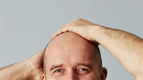 bald head care summary baldshop