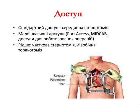 Аорто-коронарне шунтування - презентация онлайн