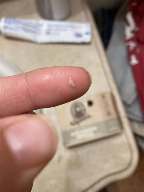 Immediately upon waking up today I felt a scratch in my eye. I couldn’t