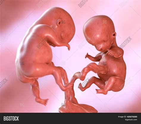 Human Embryo Twins