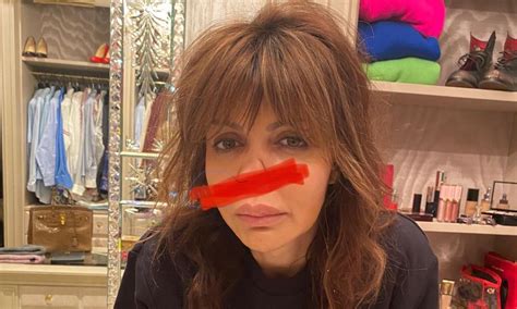 Лишившаяся носа Алиса Аршавина рассказала о пластической операции | theDay