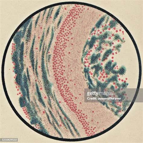 49 Corynebacterium Diphtheriae Stock Photos, High-Res Pictures, and ...