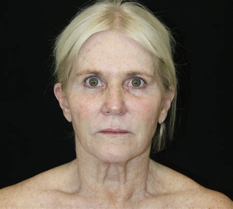 New facial recognition for palm beach county arrest search coming 33