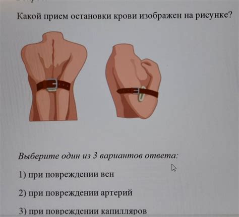 Какой прием остановки крови изображен на рисунке? - Школьные Знания.com