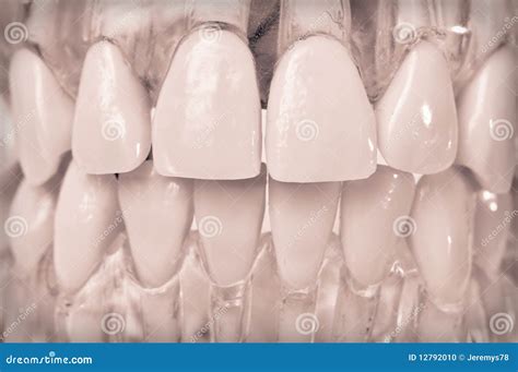 model teeth  plastic gums stock photo image  dental gums
