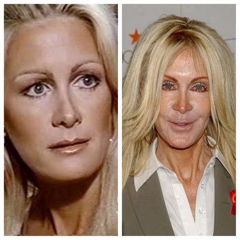 Imagefap Celebrities: Before And After Photos That Will Amaze You. Image 20