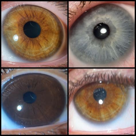 me and friends eyes! : r/WhatisMyEyeColour