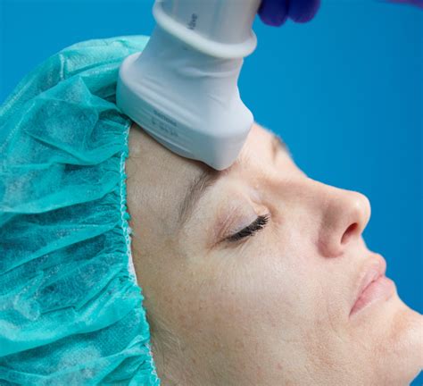 academy anatomy forehead cutaneous