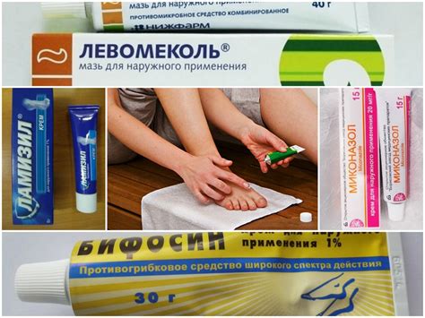 6 лучших кремов от грибка на ногах - список, цена и аналоги