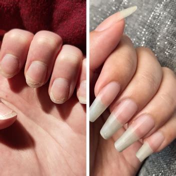UltraGrow Nail Serum - Liaison Growth