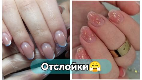 Почему отслаивается гель?/Моя работа 😒/Укрепление ногтей#маникюр - YouTube
