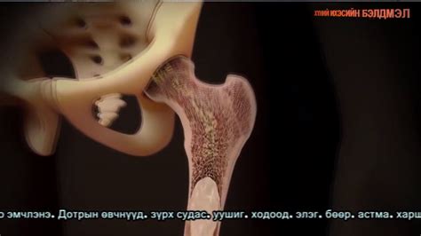 LAENNEC Хүний эхэсийн тарилга - YouTube