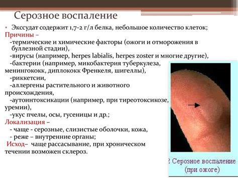 Воспаление - презентация онлайн