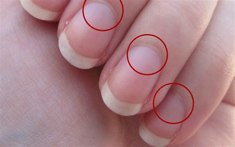 O que significa essa marca branca na base das unhas? - .: Jornal ...