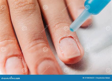 manicure process cuticle   fingernail stock image image