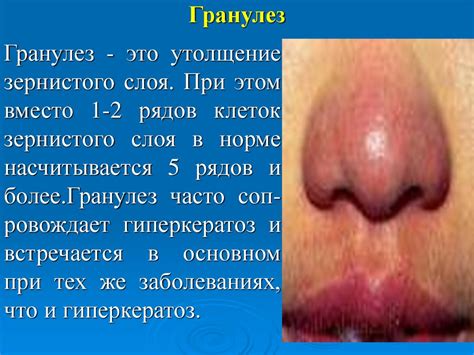 Кожные заболевания в дерматологии - презентация онлайн