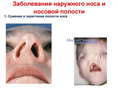Патология дыхательной системы - презентация онлайн