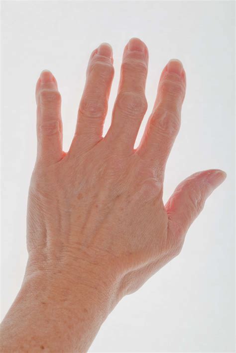 Why My Finger Joints Hurt