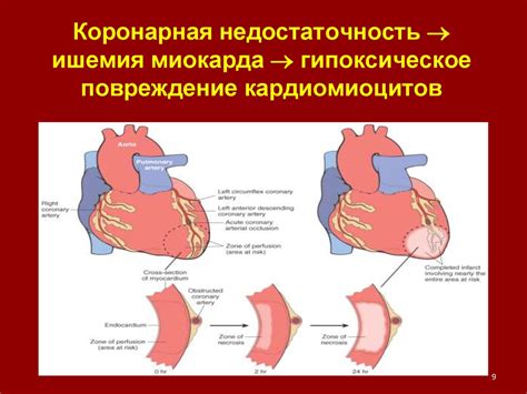 Недостаточность кровообращения - презентация онлайн