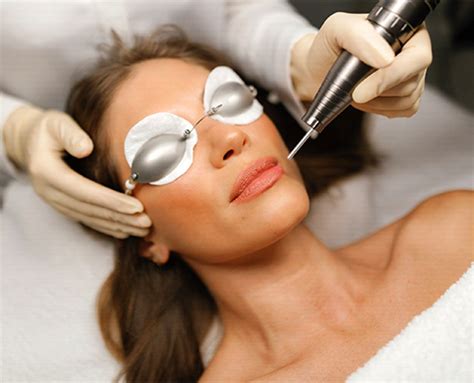 lip  tone laser lightening  dark lip pigmentation