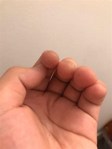 Why does my callous look like this : r/guitars