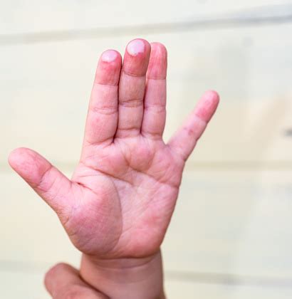Dedo Inflamado Água Quente Com Sal - Foto de Bolha No Dedo Infantil Causada Por Lesão De Água Quente e mais ...