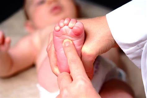 Babinski Reflex In Babies: What Is It & When to Be Concerned? | MomJunction