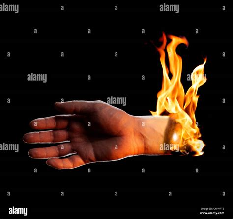 burn hand  res stock photography  images alamy
