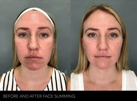 how do you get a slim face 2