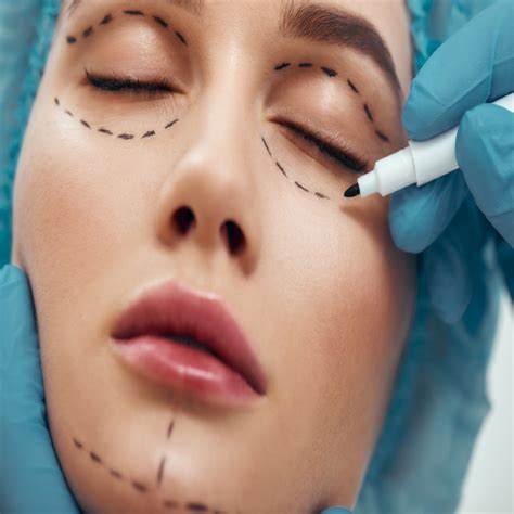 orbit oculoplasty samarpan