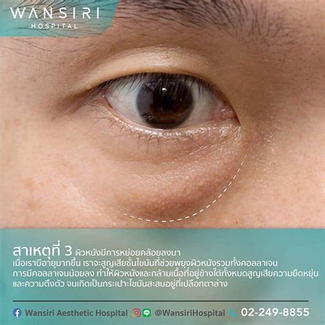 eye wansiri hospital