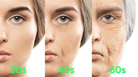 how to get rid of cheek lines