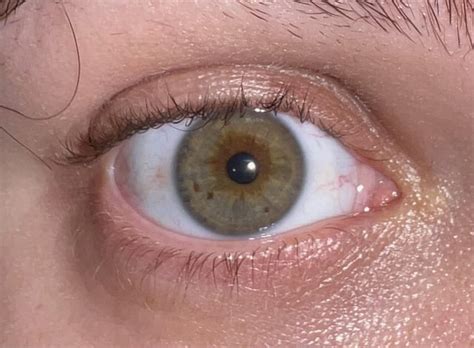 Here’s my eyes :) not sure if i have hazel or heterochromia lol. if you ...