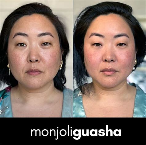 Gua Sha Visage : Utilisations, Bienfaits et Avant/Après