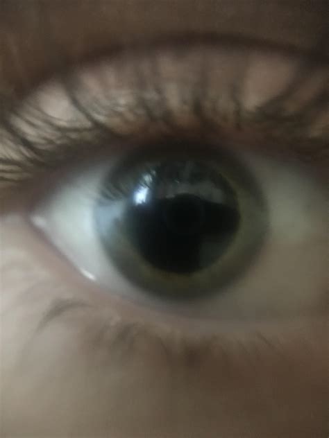 9ug dose. Why are my pupils dilating so much? : r/microdosing