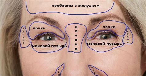 Заболевания внутренних органов
