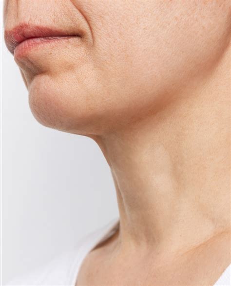 Chin & Jaw Line Fillers | Define Your Facial Features In Birmingham