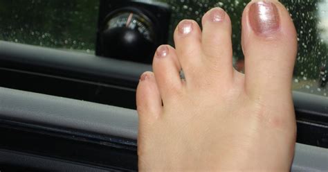 Webbed hands and feet - telebro