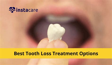 tooth loss treatment options