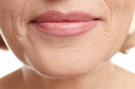 how to fix wrinkles around mouth