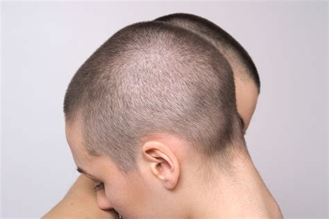 Pin on Hair | Bald girl, Short hair styles, Bald hair