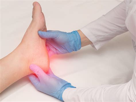 What is plantar fasciitis-Understanding and treating it
