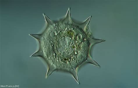 Amoebozoa ~ Everything You Need to Know with Photos | Videos